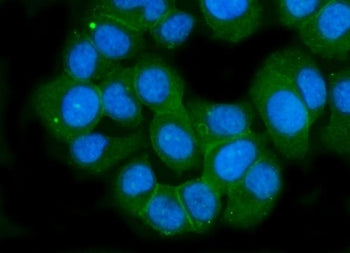 Immunofluorescent staining of FFPE human T-47D cells with GLUR2 antibody (green) and DAPI nuclear st