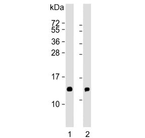 HBE1 Antibody / Hemoglobin subunit epsilon
