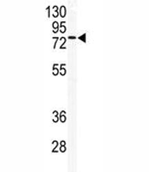 TLK2 Antibody