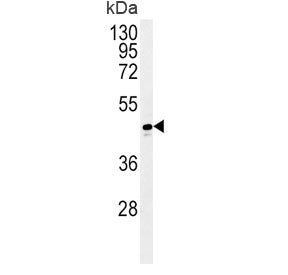 Western blot testing of human T-47D cell lysate with ADH1C antibody. Predicted molecular weight ~40 