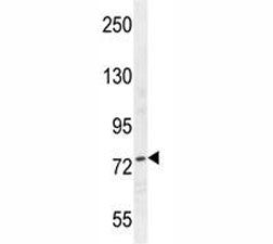 Nucleolin antibody western blot analysis in HepG2 lysate. Predicted molecular weight is 77 kDa, obse