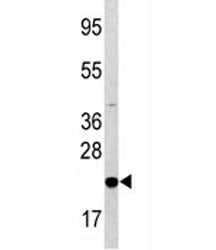 Bad Antibody