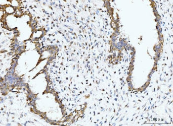 BCKDK Antibody / BCKDHKIN