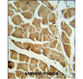 IHC staining of FFPE human skeletal muscle tissue with CAPN3 antibody. HIER: steam section in pH6 ci