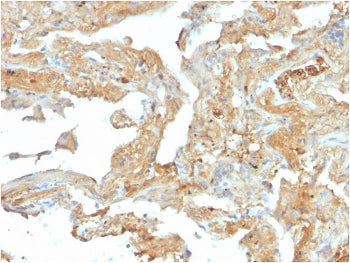 FN1 Antibody / Fibronectin