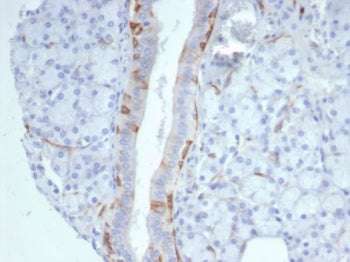 IHC staining of FFPE human prostate tissue with Cytokeratin 14 antibody (clone KRT14/7047R). HIER: b