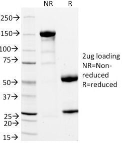 SDS-PAGE Analysis of Purified, BSA-Free CD11a Antibody (clone DF1524). Confirmation of Integrity and