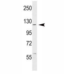 c-Abl Antibody (ABL1)