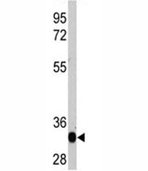 LIN28A Antibody