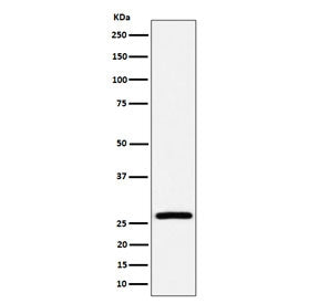 Western blot testing of human HepG2 cell lysate with Adenylate kinase 2 antibody. Predicted molecular weight ~26 kDa.