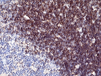 CD1a Antibody
