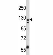 Western blot analysis of CD11c antibody and MDA-MB231 lysate. Predicted molecular weight: 128~150 kDa.