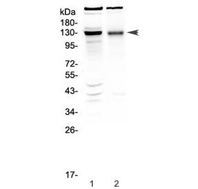 BMPR2 Antibody