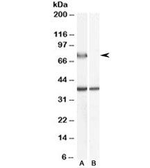 Western blot testing of human liver lysate with ACOX2 antibody at 0.5ug/ml with [B] and without [A] 