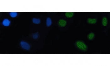 Immunofluorescent staining of FFPE human SiHa cells with NKX2.5 antibody (green) and DAPI nuclear st