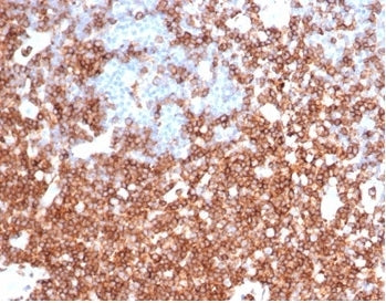 IHC staining of FFPE human tonsil tissue with SPN antibody (clone rSPN/6563) at 2ug/ml in PBS for 30