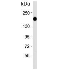Epidermal growth factor receptor Antibody (EGFR)
