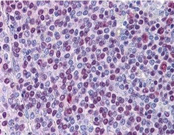 NONO Antibody / p54nrb