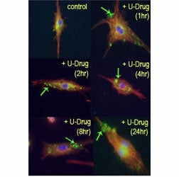 LC3B Antibody (MAP1LC3B)