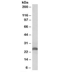 Apolipoprotein D Antibody