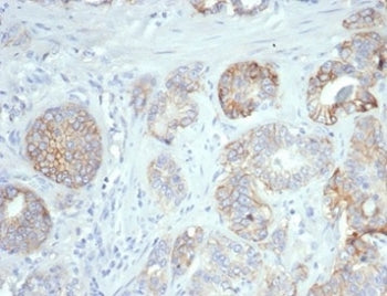 B7-H3 Antibody / CD276
