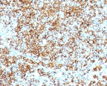 CD45RB Antibody (B-cell marker)