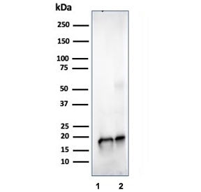 Western blot testing of human 1) JEG-3 and 2 )LNCaP cell lysate using SOD1 antibody (clone SOD1/4329