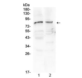 Western blot testing of 1) rat testis and 2) mouse testis tissue with Choline acetyltransferase anti