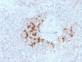TRAF1 Antibody