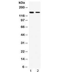 Western blot testing of human 1) HeLa and 2) MCF7 cell lysate with SAFB antibody at 0.5ug/ml. Predic