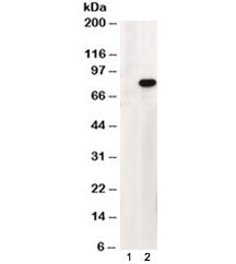 ABCD1 Antibody