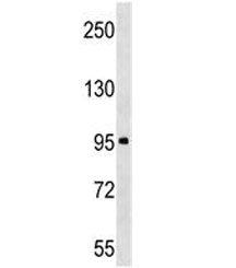 ABI3BP Antibody