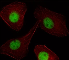 PR Antibody