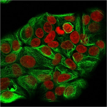 Immunofluorescent staining of MeOH-fixed human MCF7 cells with Cytokeratin 15 antibody (clone KRT15/