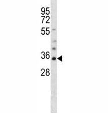 Olig1 Antibody