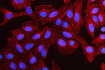 MMP19 Antibody / Matrix metalloproteinase 19