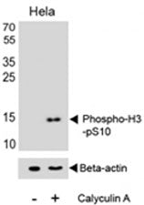 Phospho-Histone H3 Antibody (pS10)