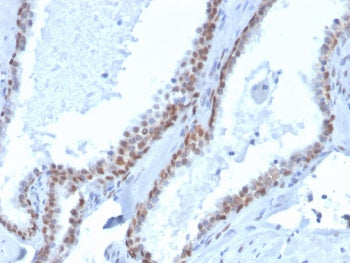 p40 / deltaNp63 Antibody