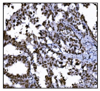 HDAC2 Antibody