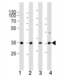 Western blot analysis of lysate from (1) human HeLa cell line, (2) mouse spleen, (3) rat lung, (4) r