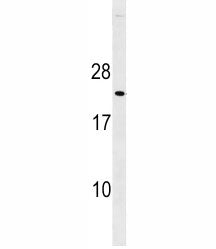 p27Kip1 antibody western blot analysis in mouse heart tissue lysate. Predicted molecular weight ~27k