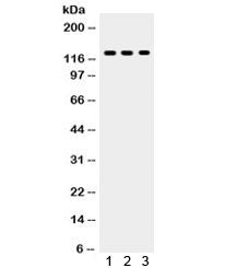 Western blot testing of 1) MCF7, 2) COLO320 and 3) Jurkat lysate with TLR7 antibody. Expected/observ