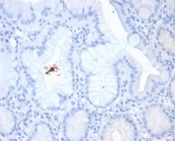 IHC staining of H. pylori-infected FFPE human stomach tissue with Helicobacter pylori antibody (clon