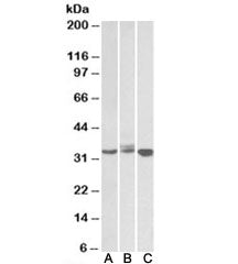 Western blot testing of Daudi (A), Jurkat (B) and K562 (C) lysates with Livin antibody at 0.5ug/ml. 