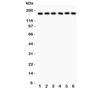 PAPP-A Antibody