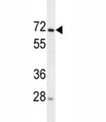 MIPEP Antibody / Mitochondrial intermediate peptidase, 0.4ml