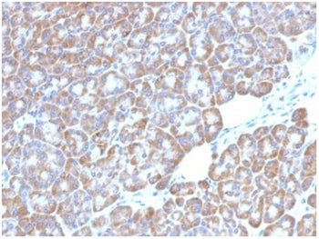 LMO2 Antibody / Rhombotin 2