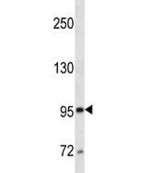 CD10 Antibody