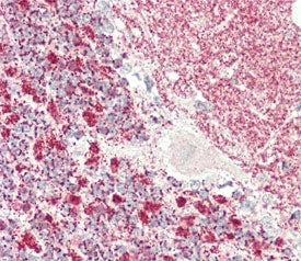 KLC1 Antibody / Kinesin light chain 1