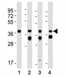 Western blot testing of EpCAM antibody at 1:2000 dilution. Lane 1: mouse kidney; 2: mouse colon; 3: 